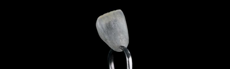 Veneers fațete dentare