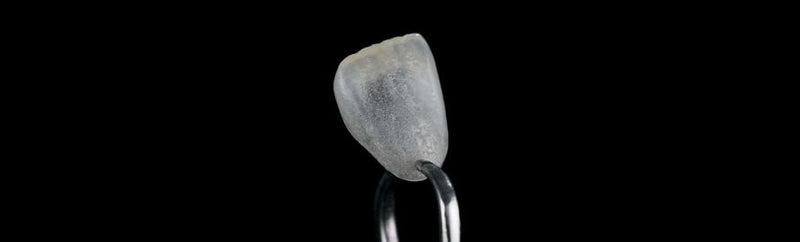 Veneers fațete dentare