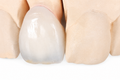 Zirconiu cu ceramică stratificată