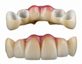 Full Monolithic Zirconia