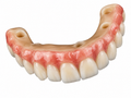 PMMA Implant