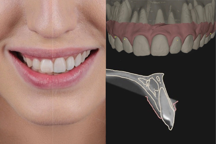Digital Smile Design (AI Motion)